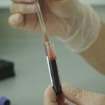 血液検査